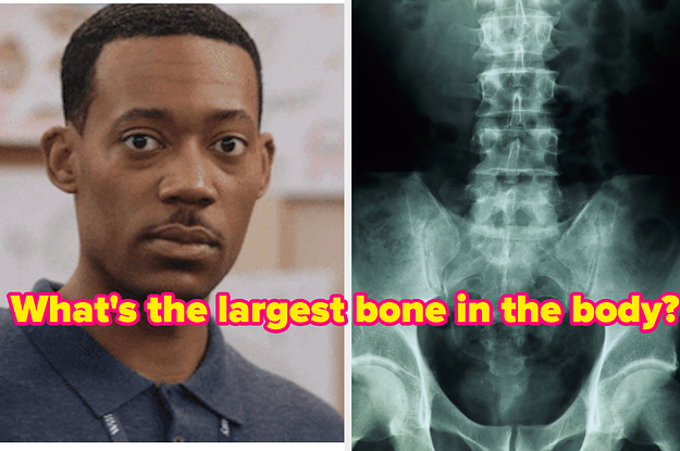 man with confused face next to a separate image of an x-ray of a spine