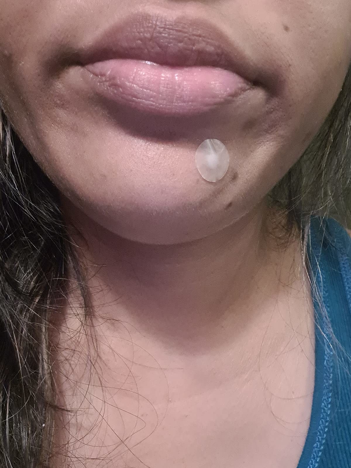 a reviewer wearing the patch on a pimple on their chin