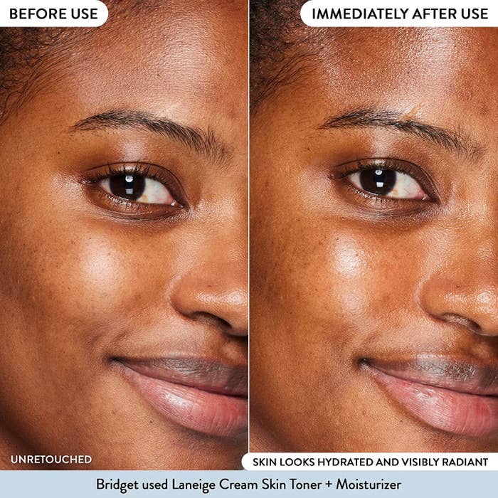before and after of model&#x27;s face brightening and reducing dark spots
