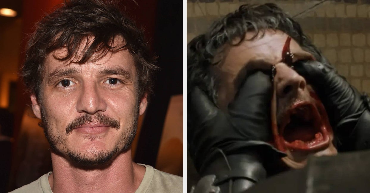 Pedro Pascal Got An Infection After Letting “Game Of Thrones” Fans Stick Their Thumbs In His Eyes Because He Was So Excited To Be Recognized
