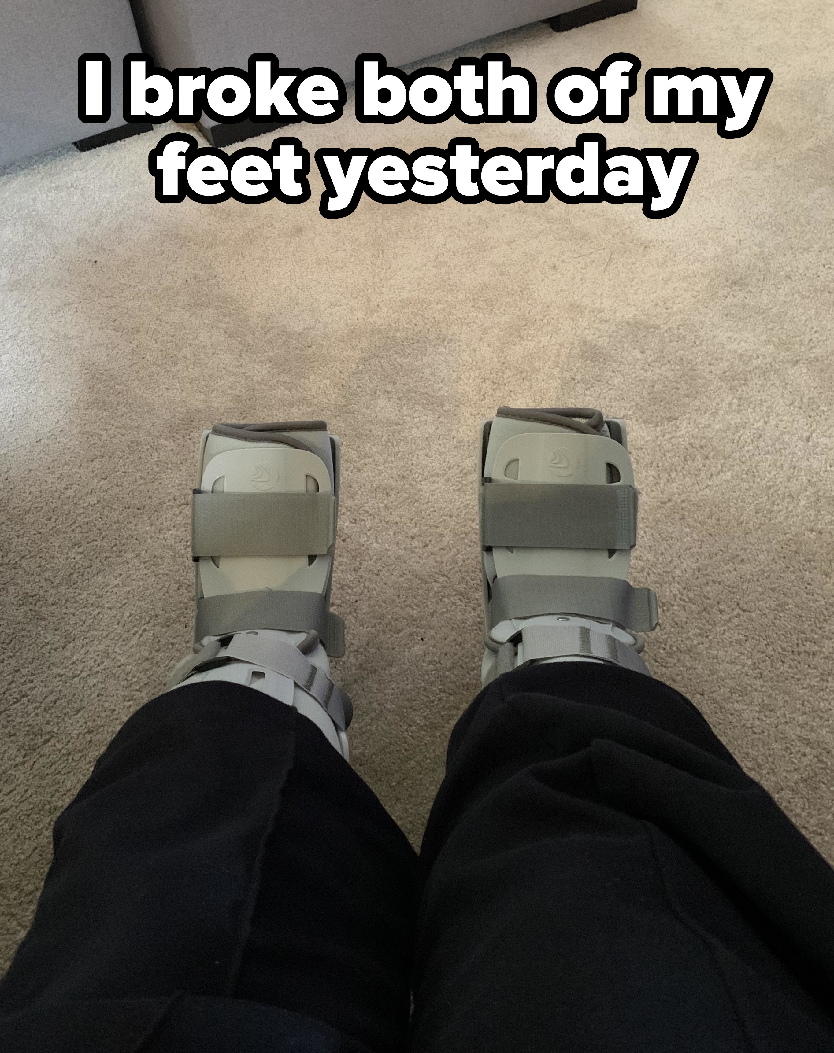 Person broke both feet, and both feet are in foot braces