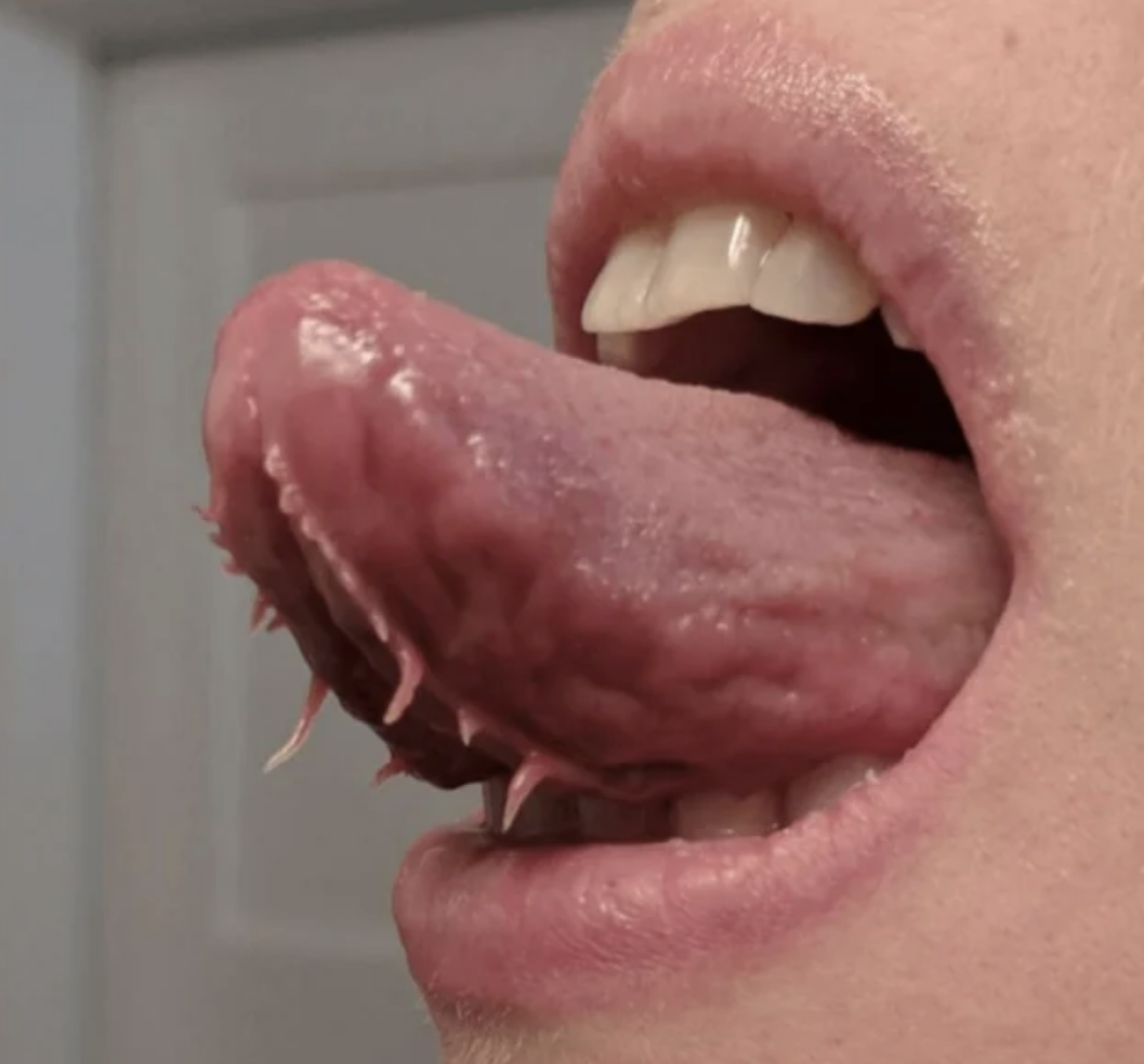 bumps and long sting-like apparatus coming out the bottom of the tongue