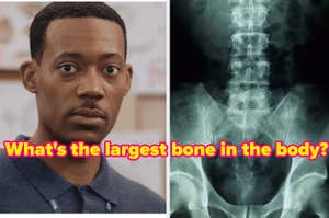 man with confused face next to a separate image of an x-ray of a spine