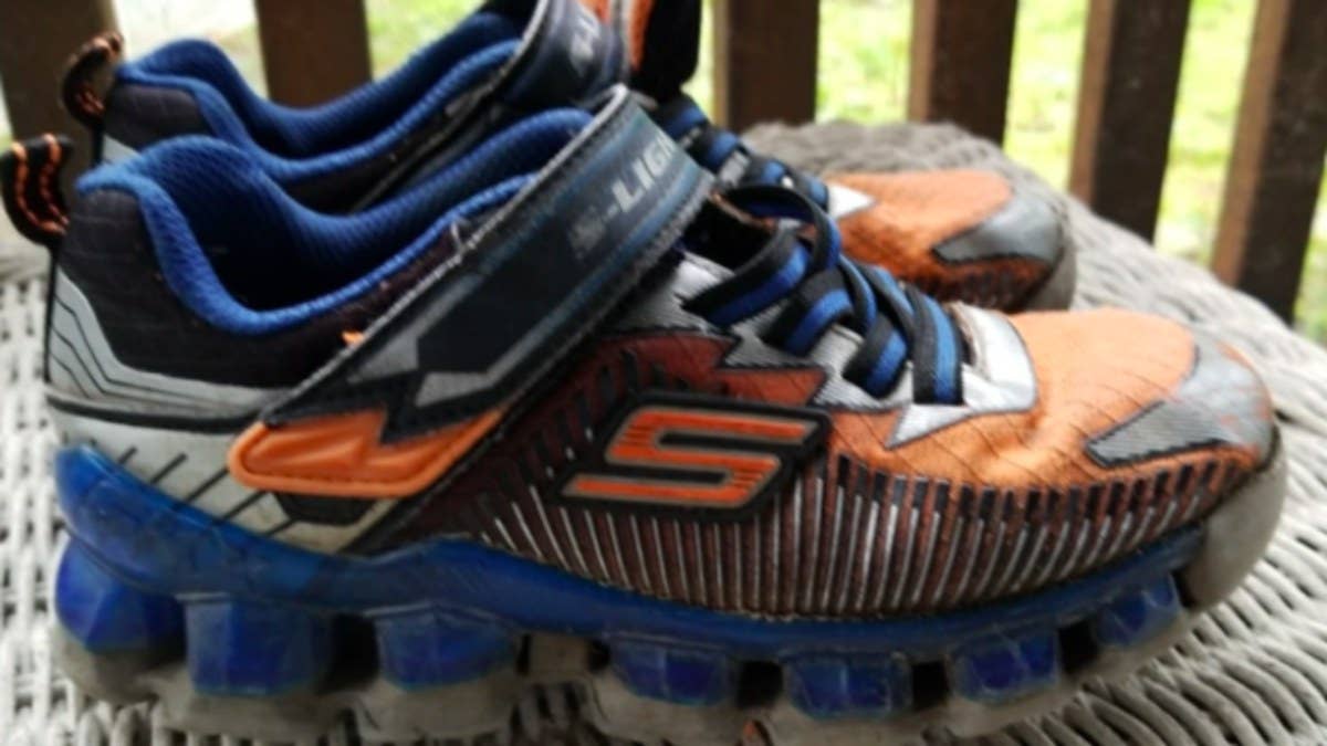 Skechers could find itself in legal trouble following an incident in which a pair of its light-up sneakers gave a kid second degree burns on his feet.
