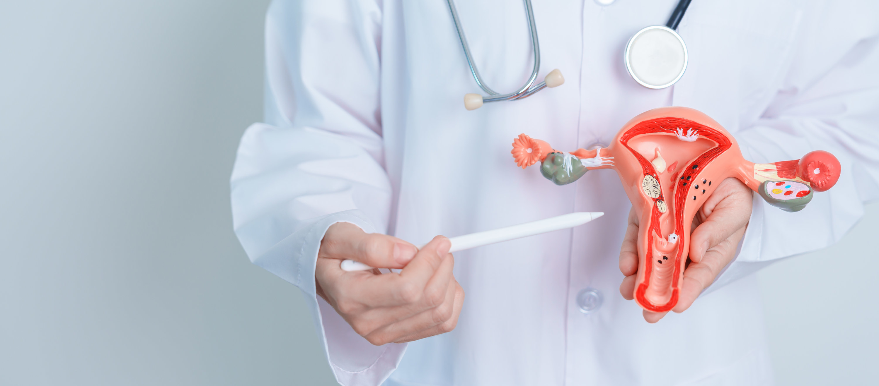 Doctor holding Uterus and Ovaries model.