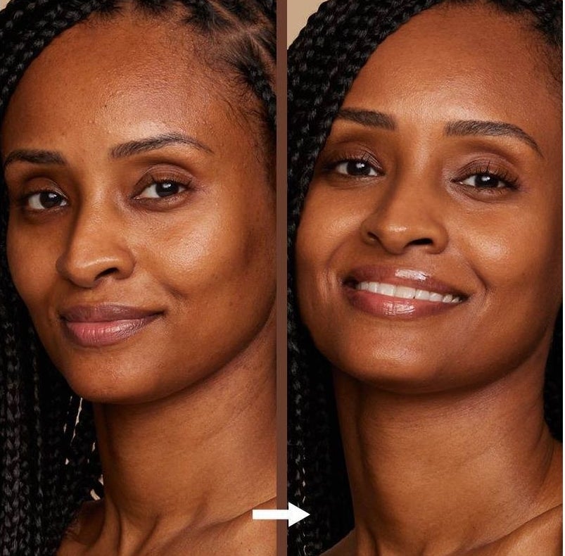 A model showing their before and after photos after using the product.