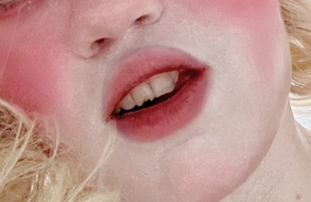 closeup of the chipped tooth