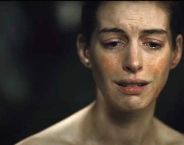 Anne Hathaway in ';Les Miserables', an example of filming hurting actors' mental health