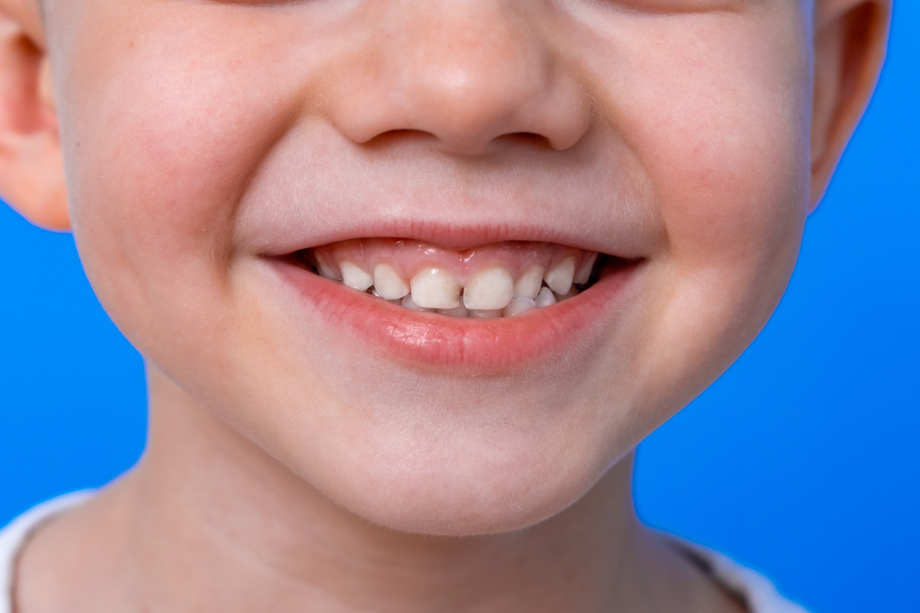 close up of child&#x27;s teeth as they smile