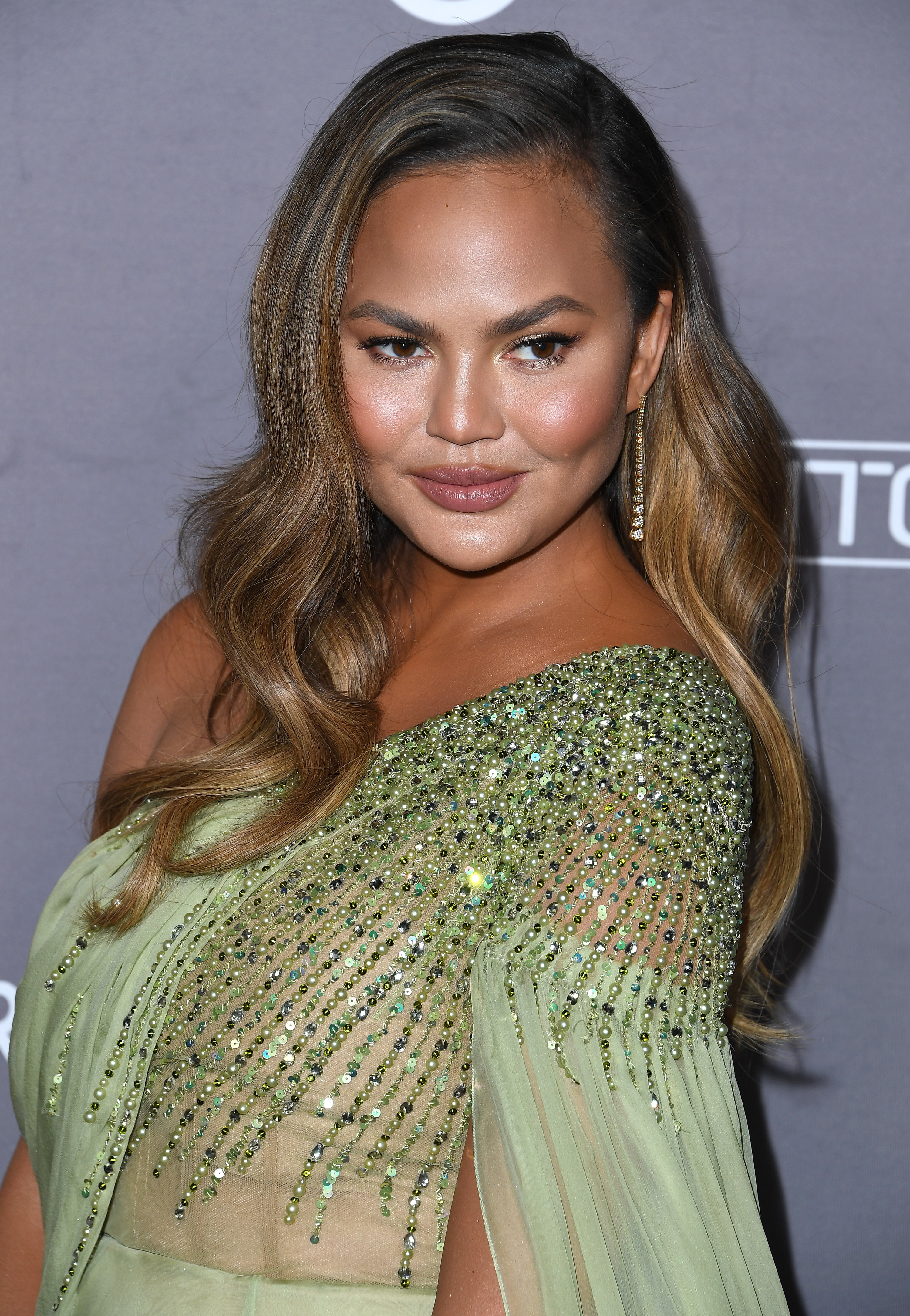 Chrissy Teigen Responds To Comment About Her New Face