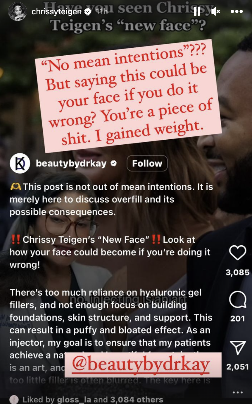 Chrissy responds to post critiquing her &quot;puffy and bloated&quot; face and saying &quot;This post is not out of mean intentions&quot; by saying &quot;'No mean intentions?' But saying this could be your face if you do it wrong? You're a piece of shit; I gained weight&quot;