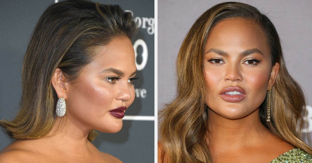 Chrissy Teigen Responds To Comment About Her New Face