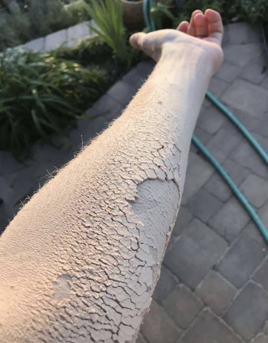 a person&#x27;s arm covered in saw dust, looking like it is crumbling away