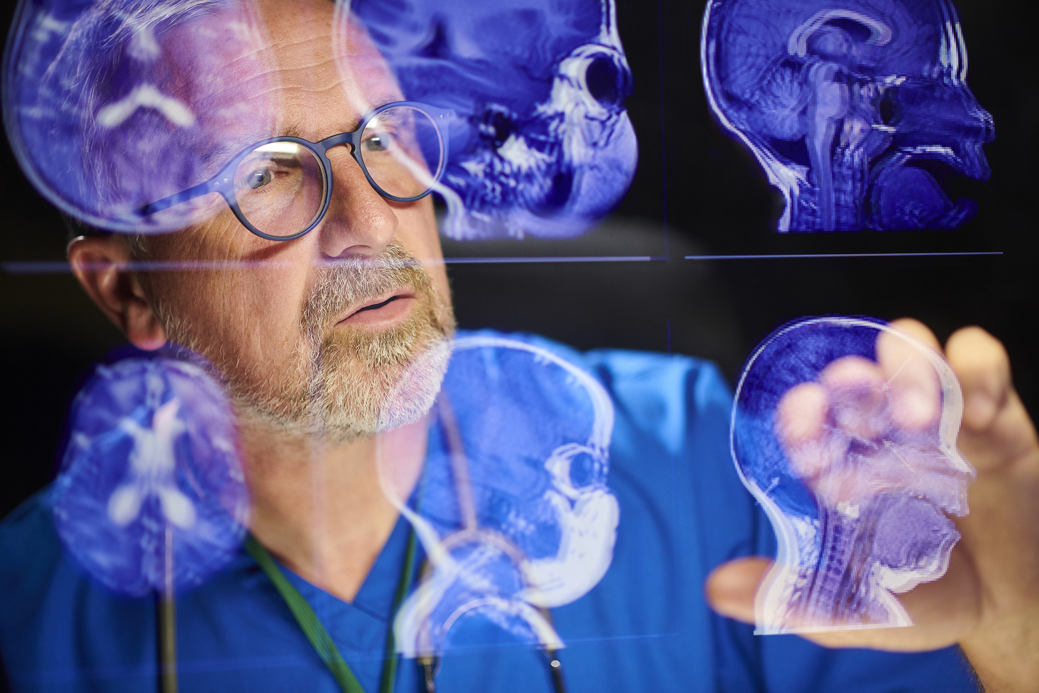 A doctor looking at x-rays