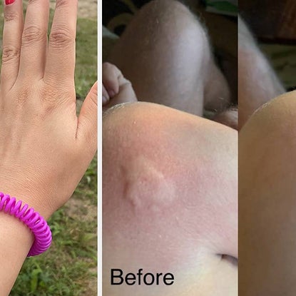 21 Reviewer-Loved Must Haves For Enjoying A Bug Bite-Free Summer