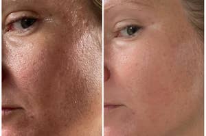 A reviewer's skin before and after use, with reduced texture