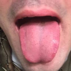 after of a reviewer's tongue looking clean and gunk-free