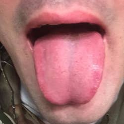 after of a reviewer's tongue looking clean and gunk-free