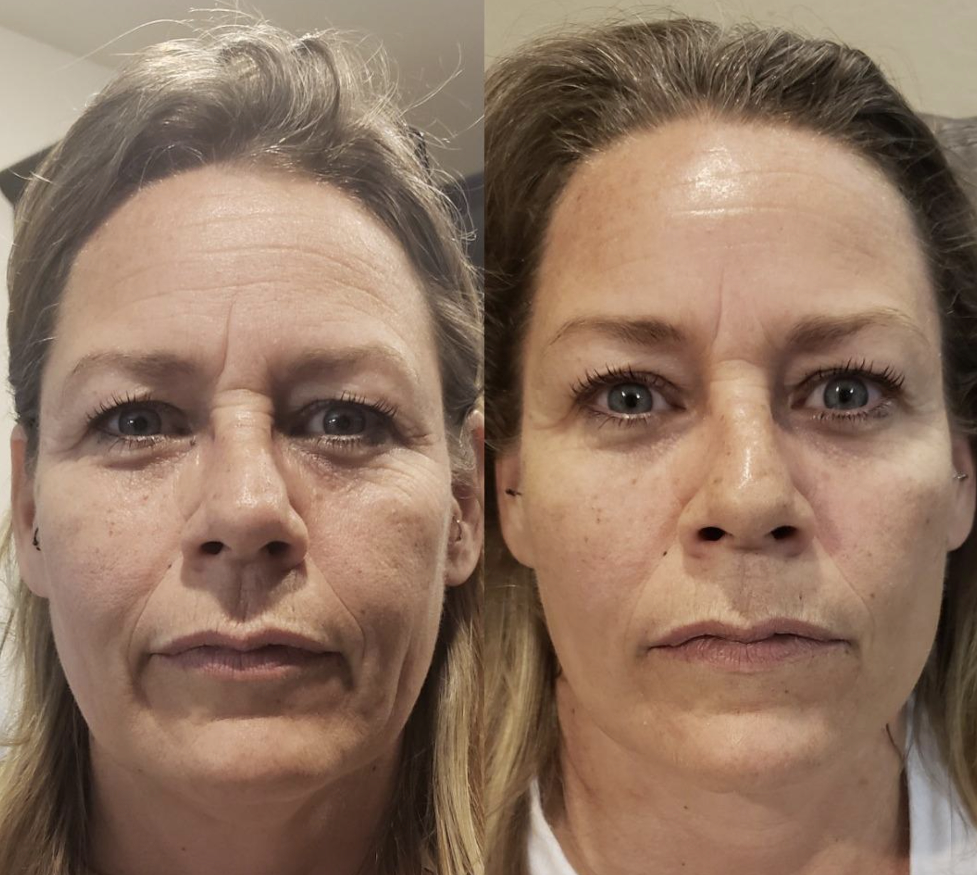 a before and after of a reviewer using the mask