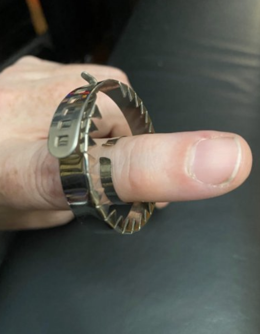 An anti-masturbation device on someone's finger
