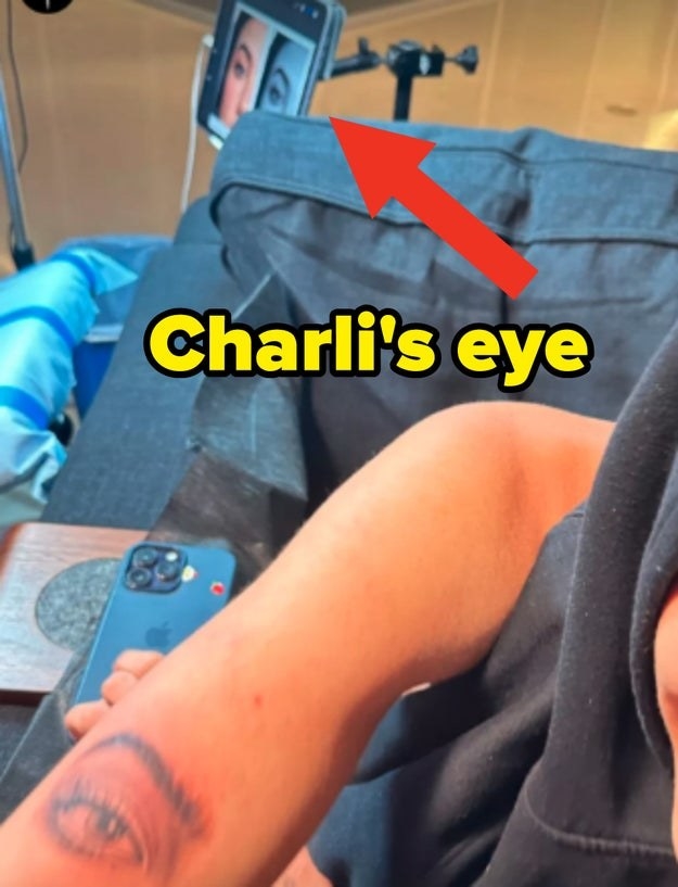 charlie&#x27;s eye tattooed