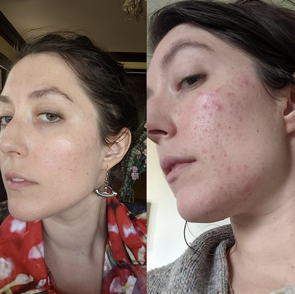a reviewer showing a before and after of the moisturizer