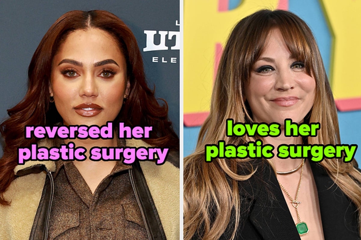 1200px x 797px - Celebs Who Embrace Cosmetic Procedures And Those Who Reversed Them