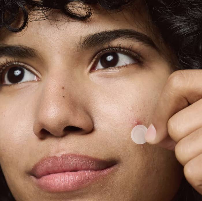 a model applies the pimple patch over their pimple