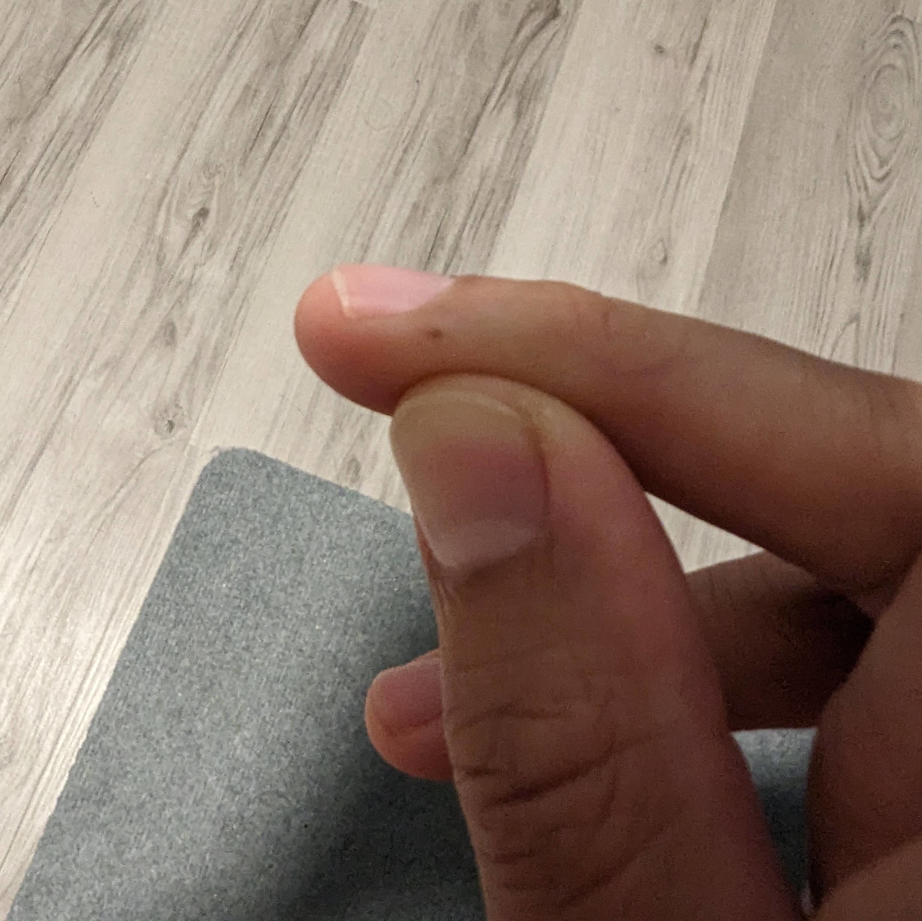 A dot on someone&#x27;s finger