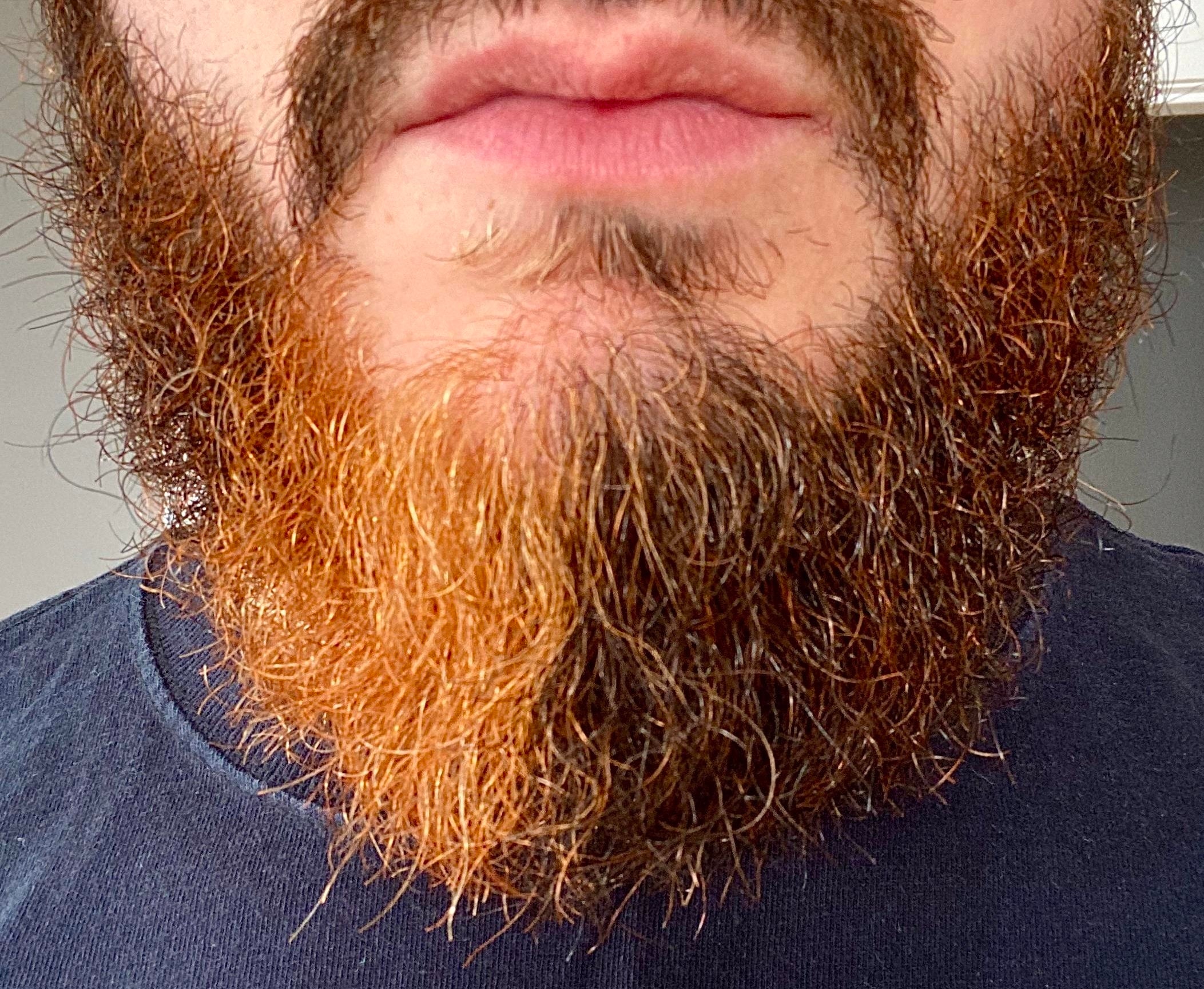 Different-colored beard