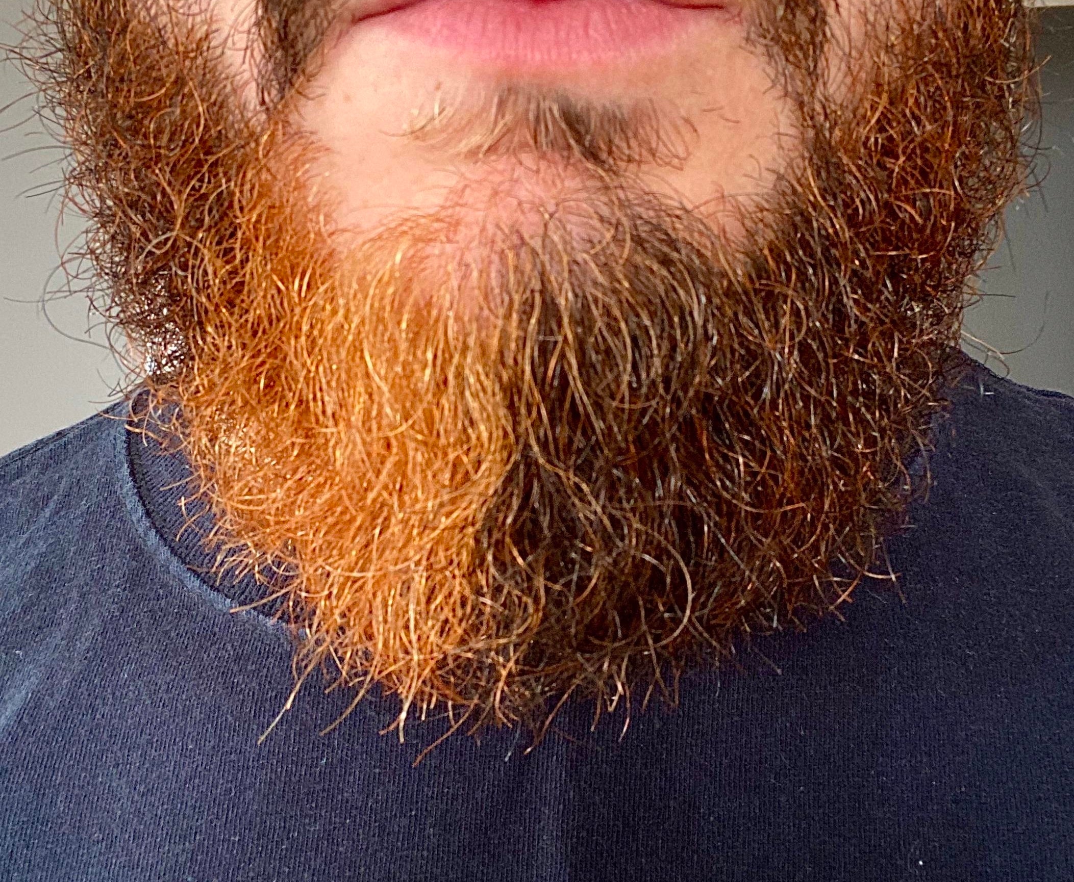 Different-colored beard