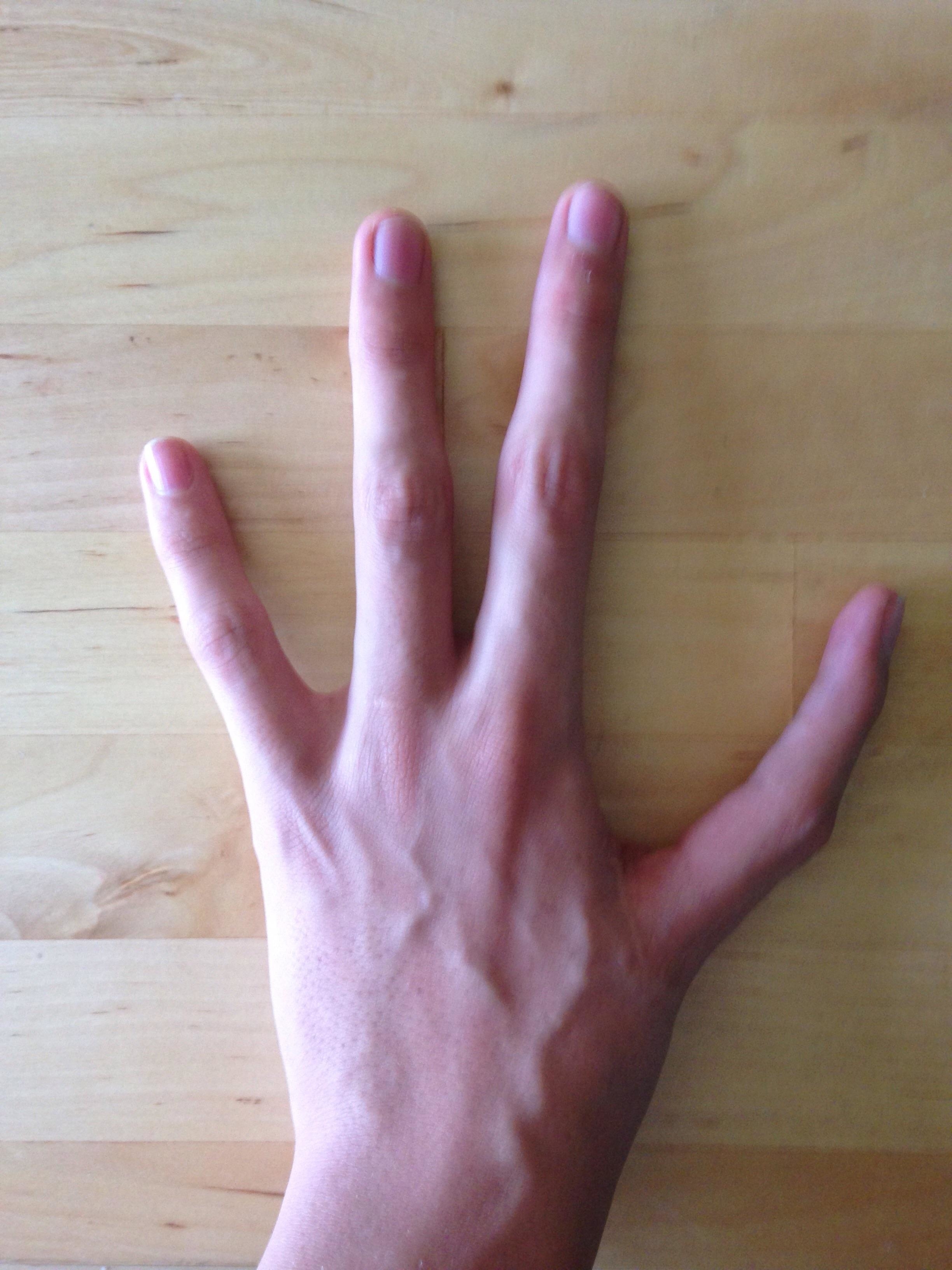 A person with four fingers on their hand