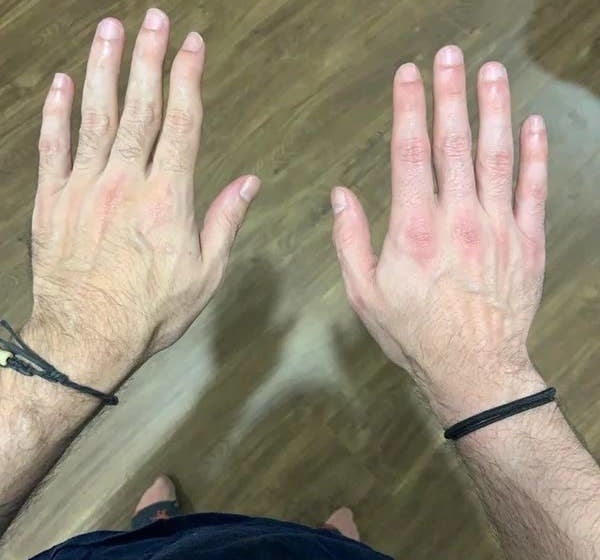 A person&#x27;s hands that look completely different