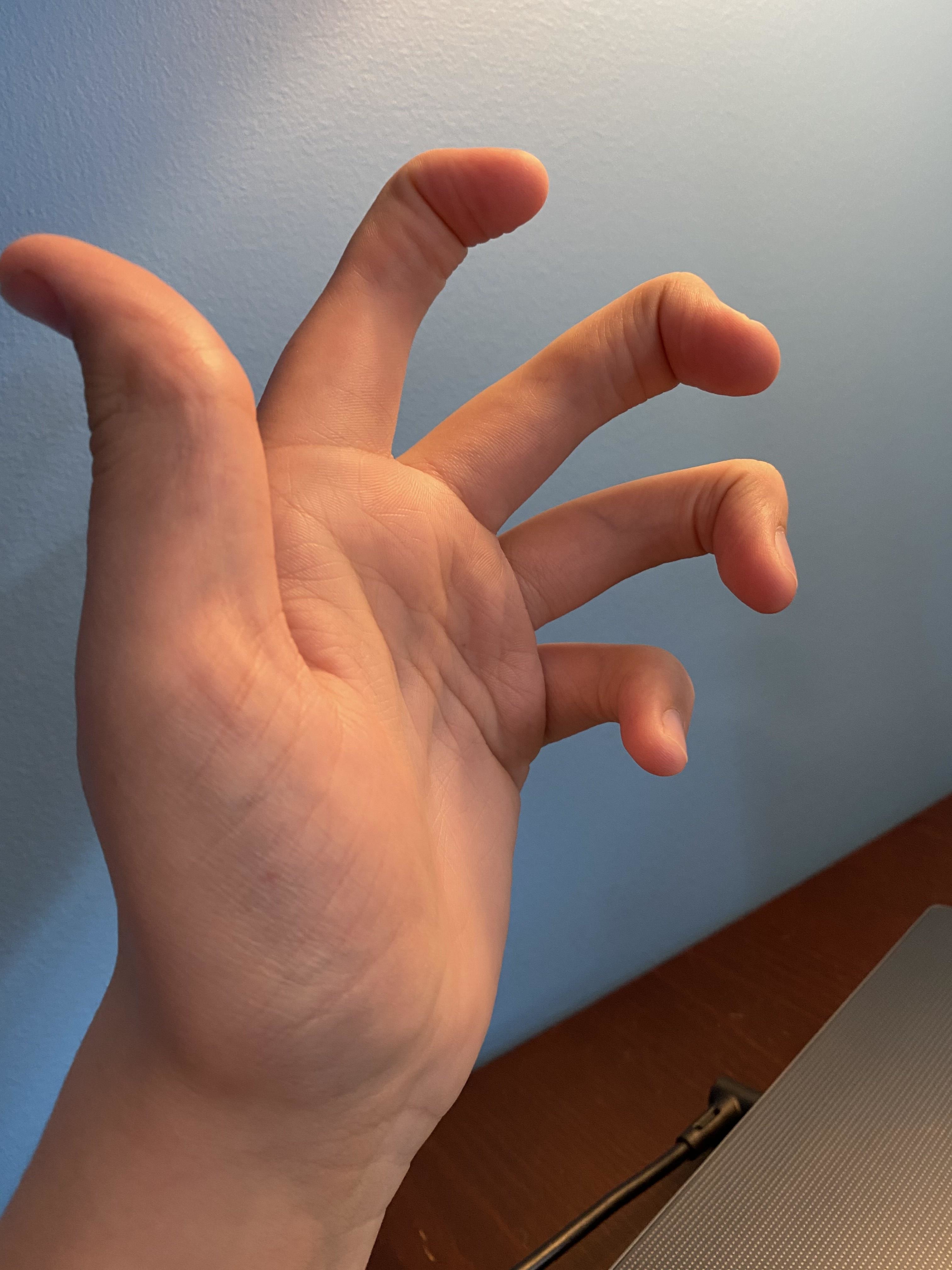 Fingers with no middle joints