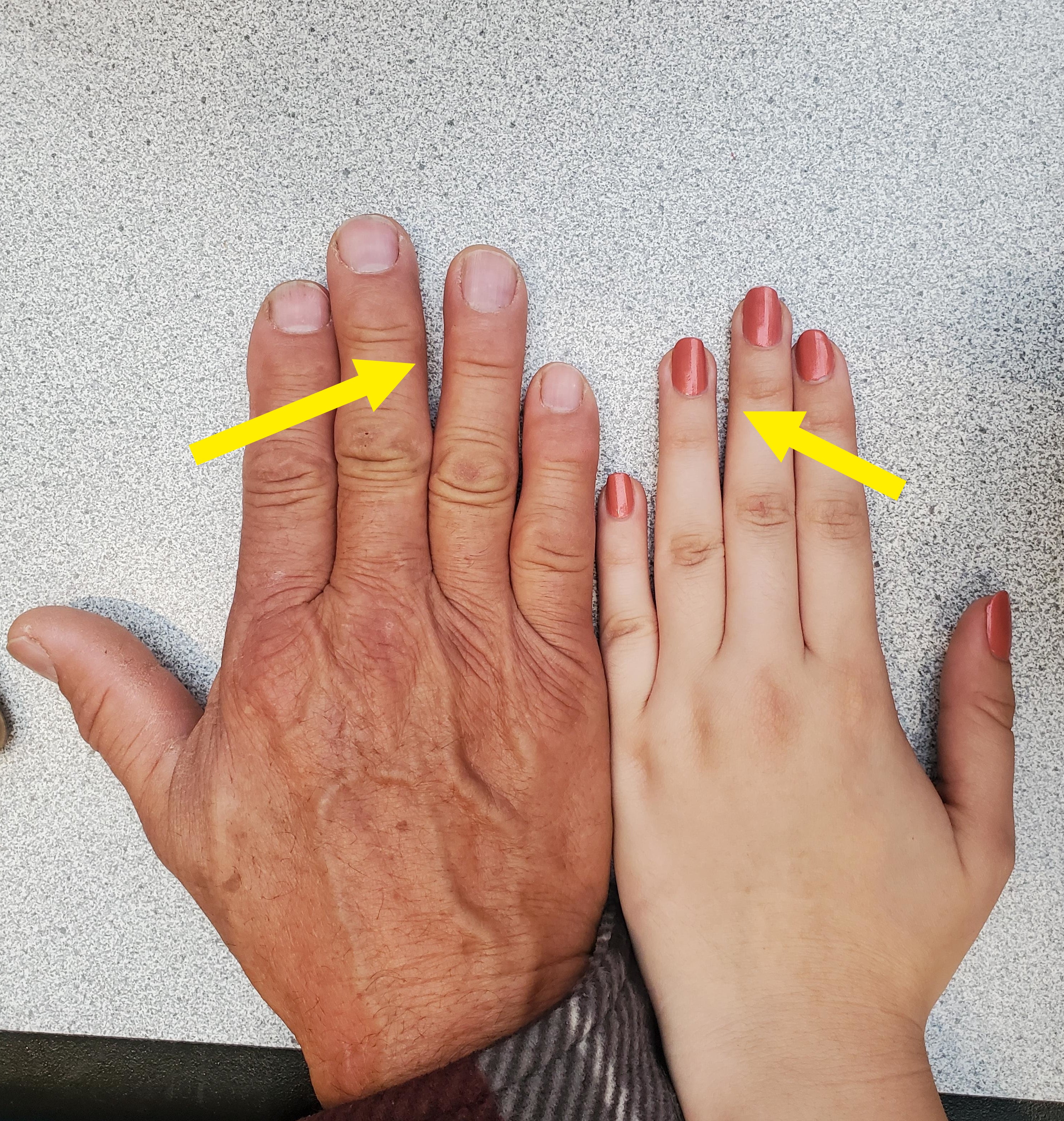 Hands with small gaps in them
