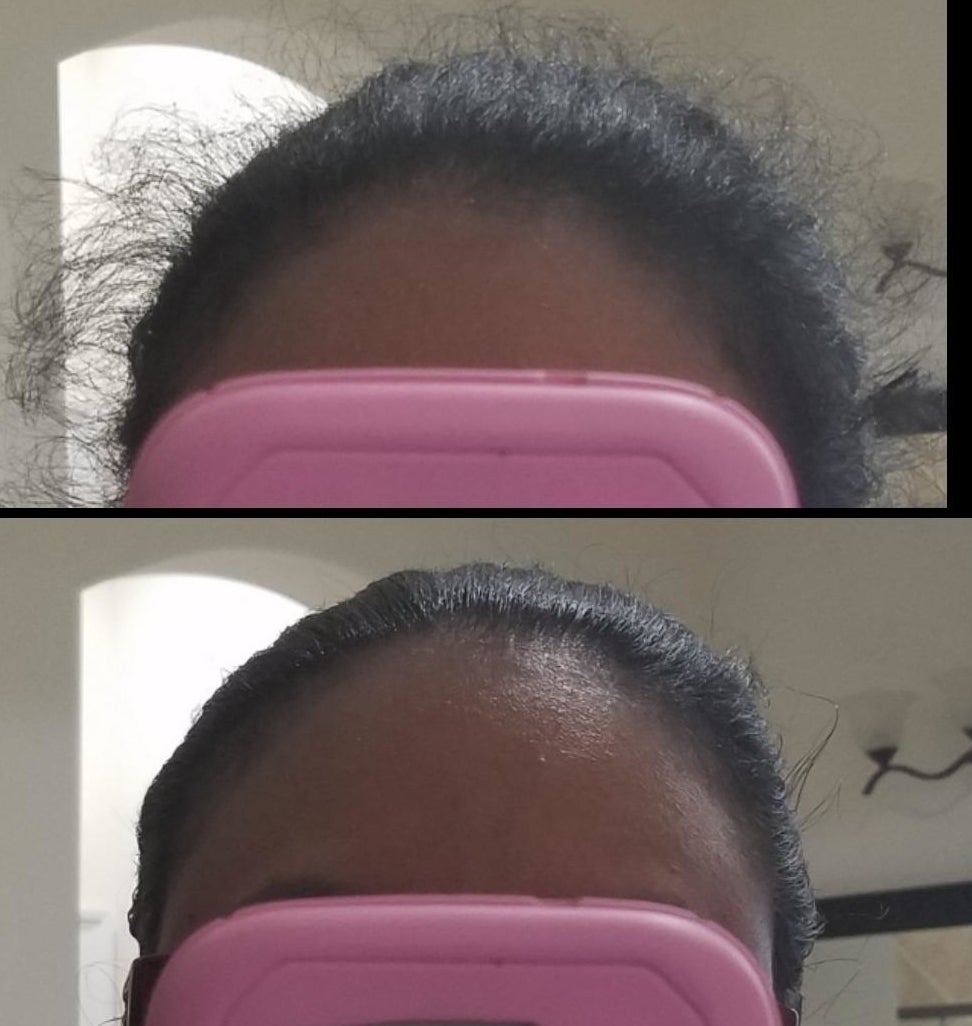Before and after photo of a reviewer using the stick. Before using their hair is frizzy all over and after using their hair is smooth with very few flyaways