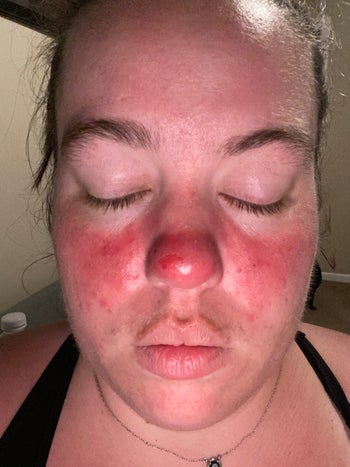 reviewer with an extremely red face