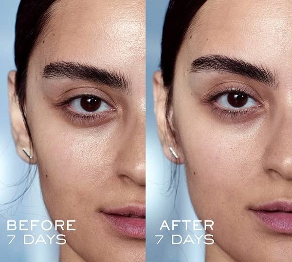 A model showing a before and after of using the product