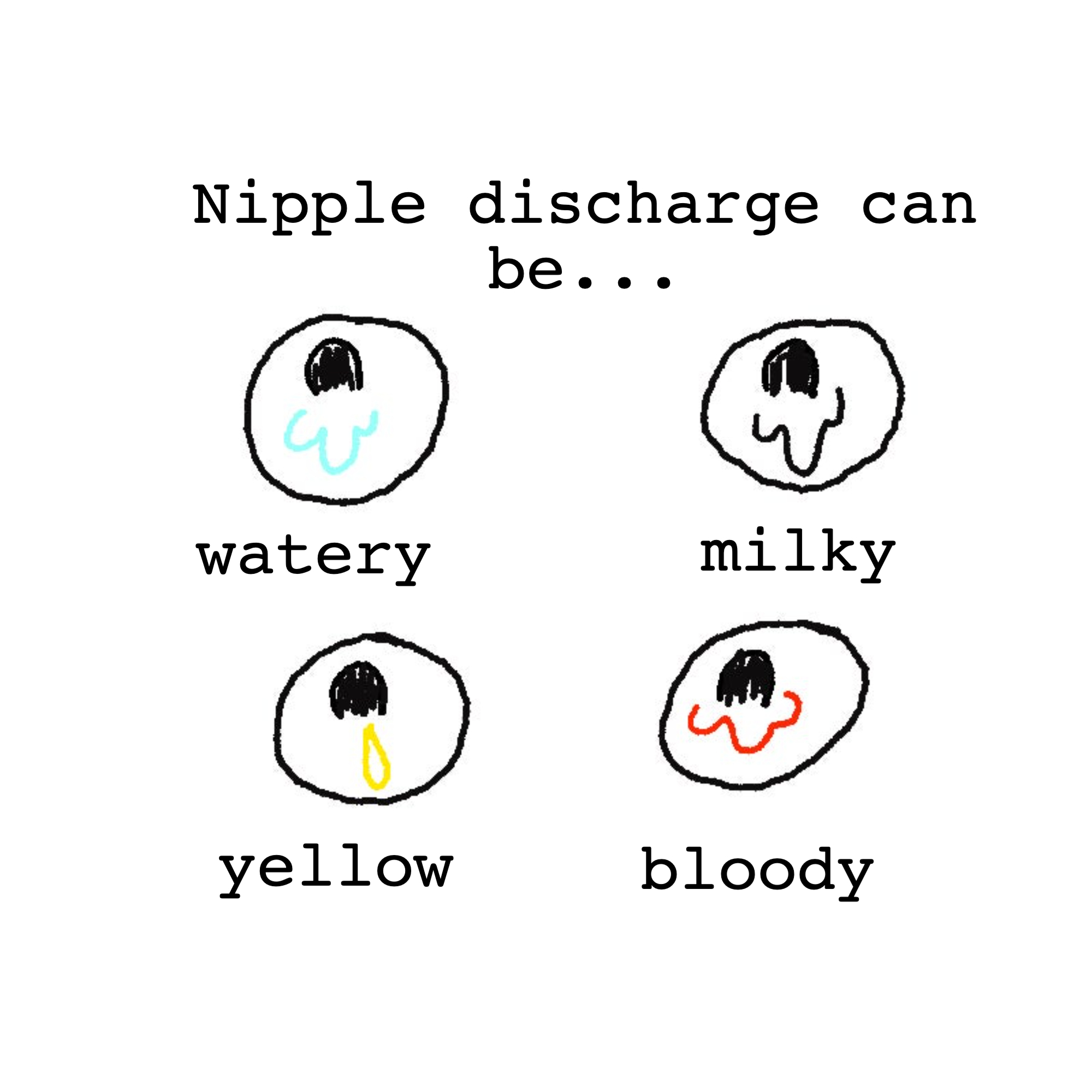 nipple discharge can be watery milky yellow or bloody