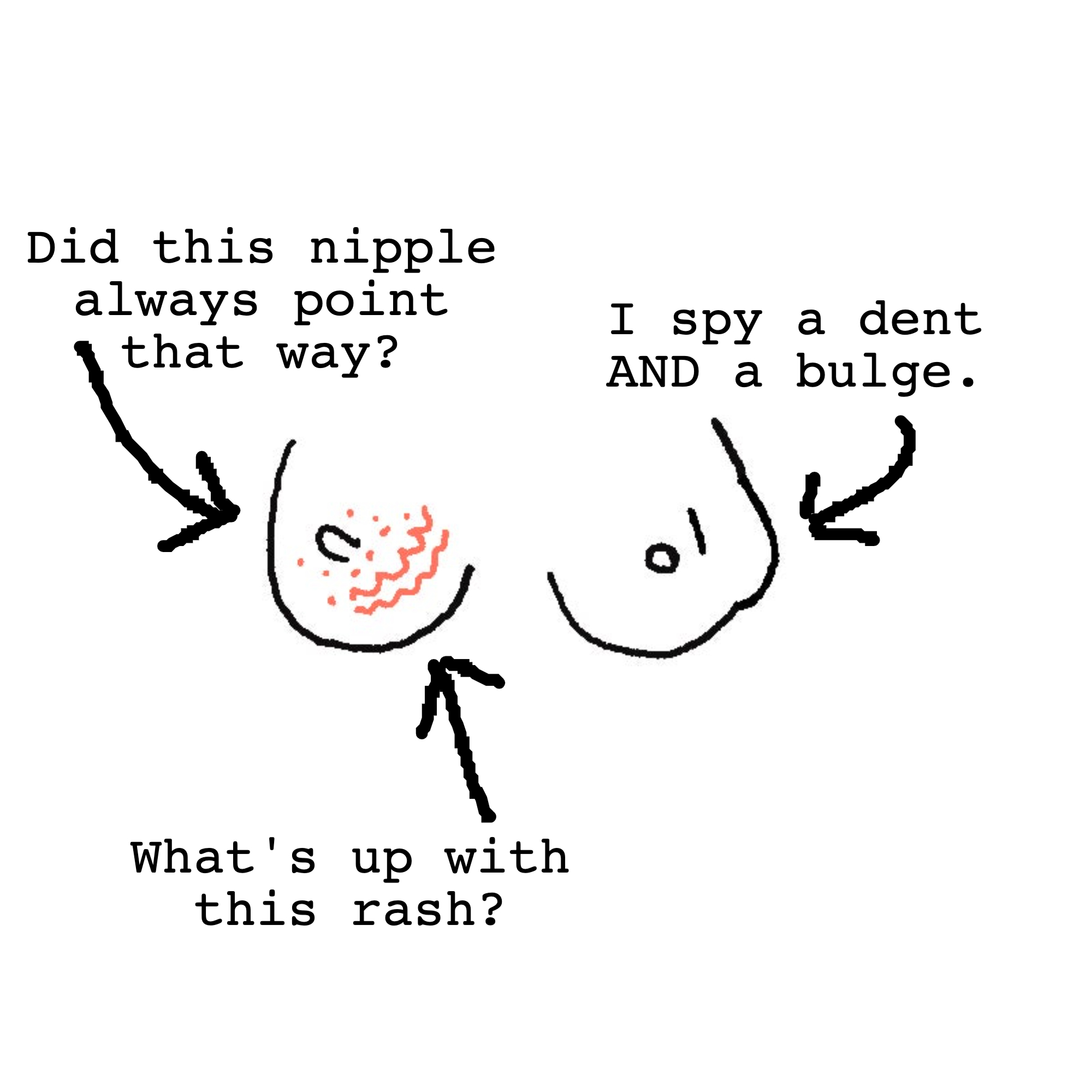 drawing showing nipple changes rash and dents and bulges on breasts