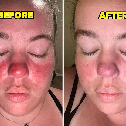 25 Products With Before And After Photos That'll Convince You To Buy 'Em Before Prime Day Is Over