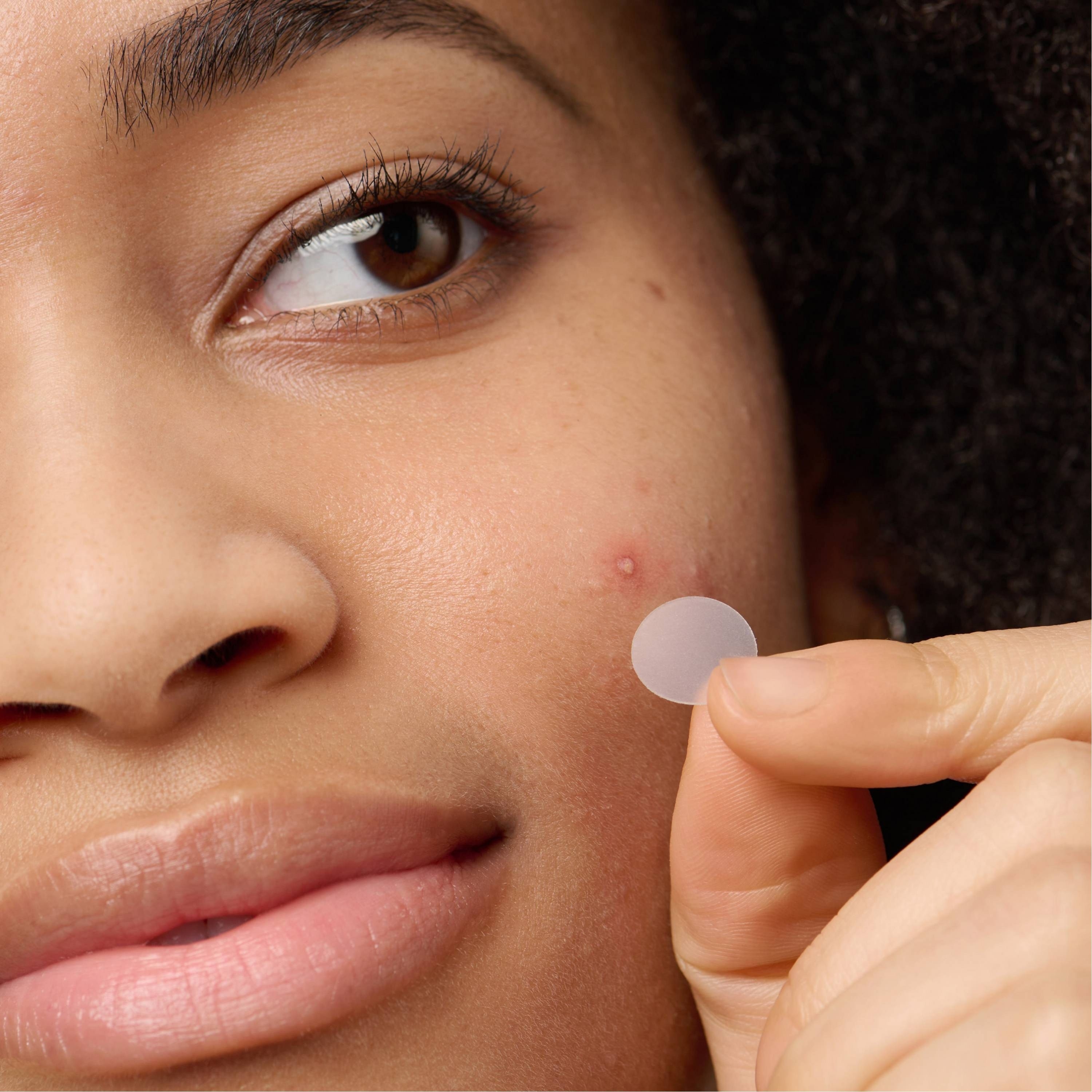 model holding a clear pimple patch next to a pimple