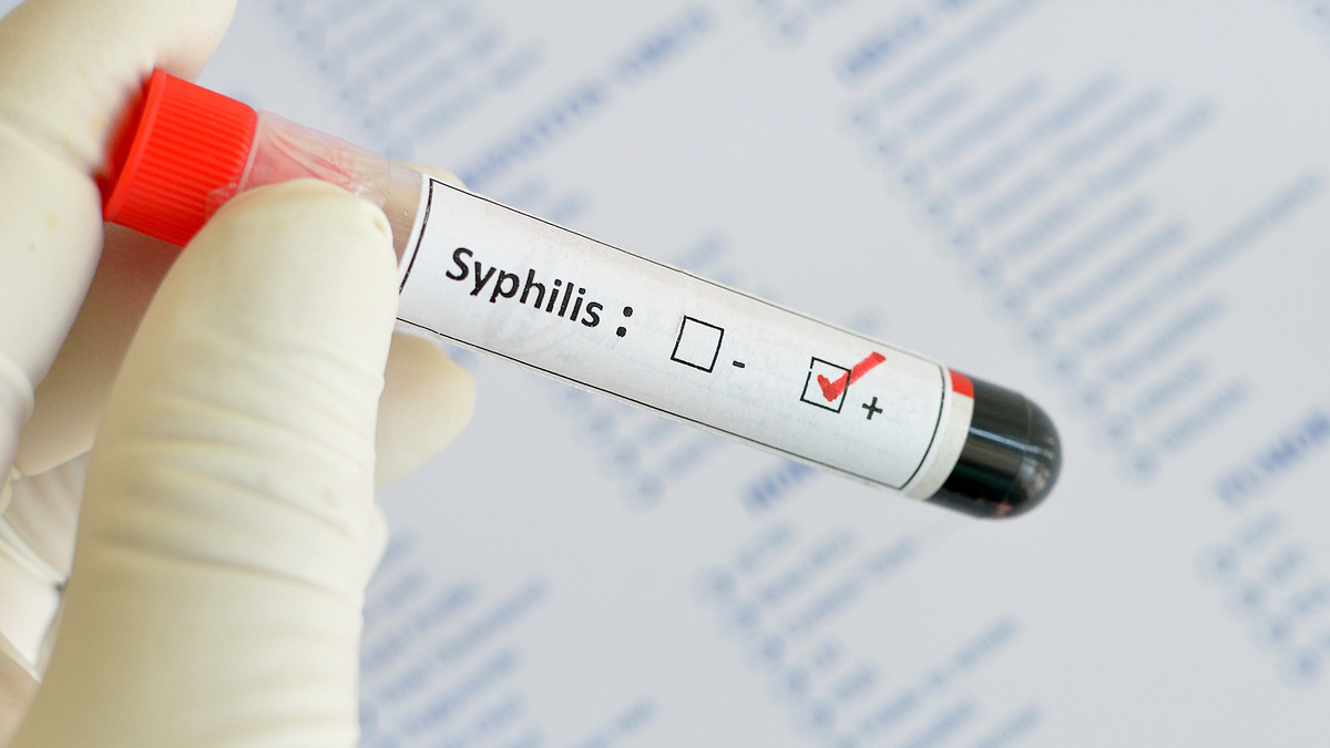 Houston Announces Syphilis Outbreak, 128 Percent Rise In Cases Among ...