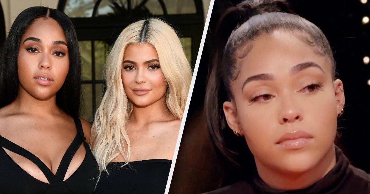 Kylie Jenner's Mind-Blowing Beauty Transformation: You've Got to See it to Believe It!