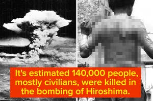 mushroom cloud aftermath after bombing of hiroshima, and a young victim with injuries on his back