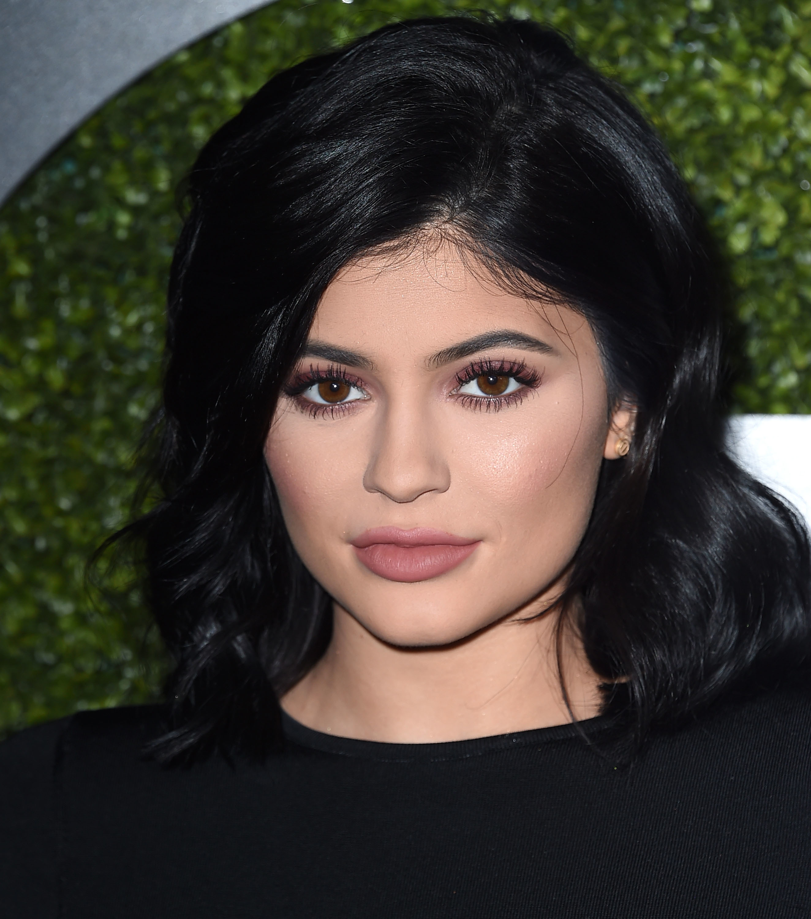 Audi Aesthetics - What do you think about Kylie Jenner breast