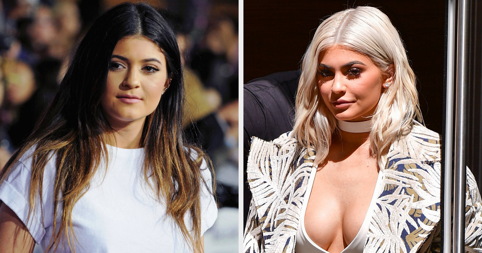 Rumor Has It: Did Kylie Jenner Get Breast Implants? - NewBeauty