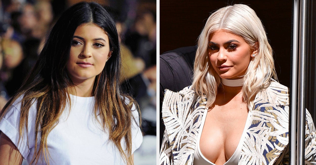 Kylie Jenner Just Casually Confirmed The Years-Long Speculation She Had A Secret Boob Job As A Teen