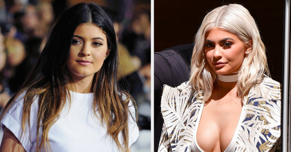 Kylie Jenner Confirms Years-Long Speculation She's Had A Boob Job