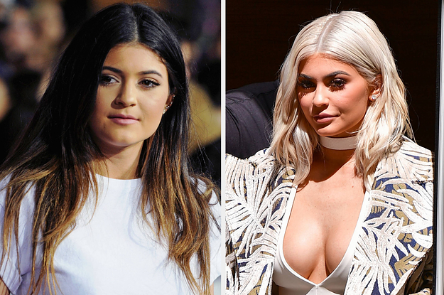 Kylie Jenner Confirms Years-Long Speculation She's Had A Boob Job